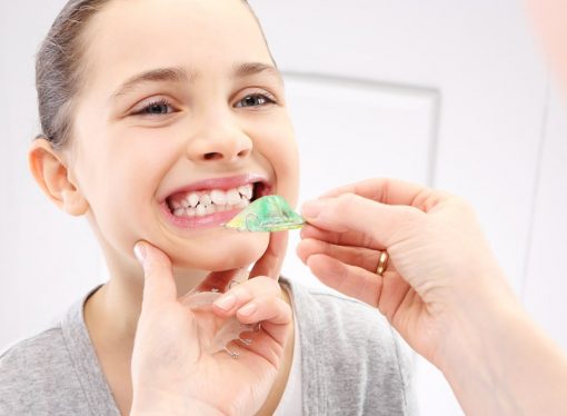 Jak powstają wady zgryzu i krzywe zęby? – poradnik